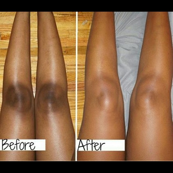 Kojie San Skin Brightening soap - Picture 5 of 7